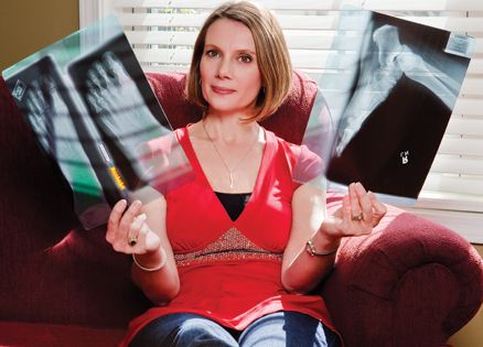 Living With Osteoporosis