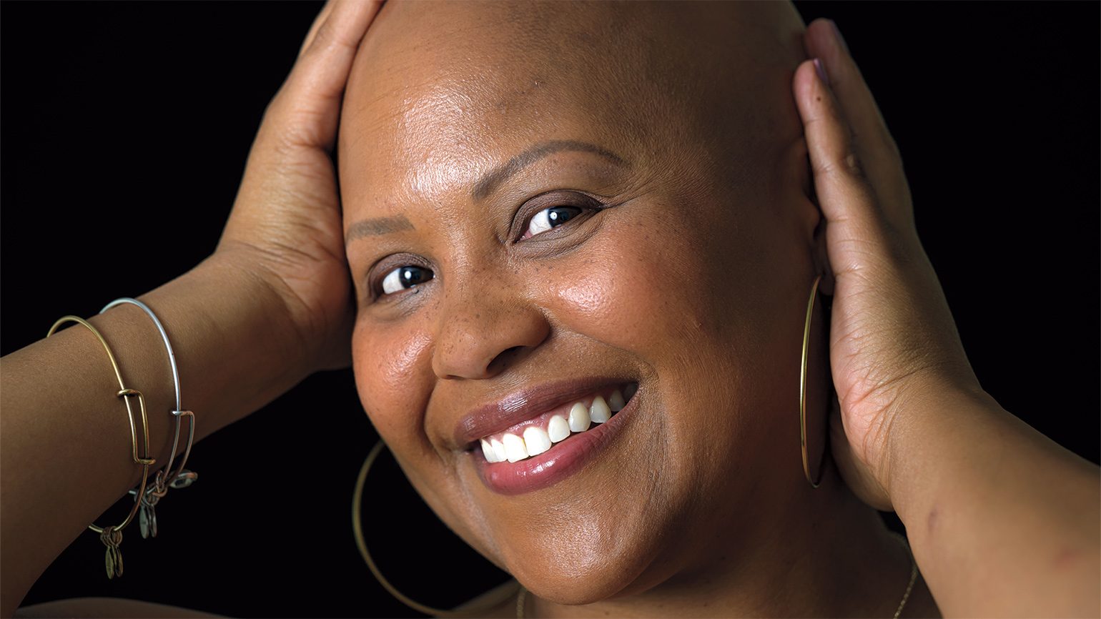 A Teacher’s Hair Loss Proves to Be a Blessing for a Student